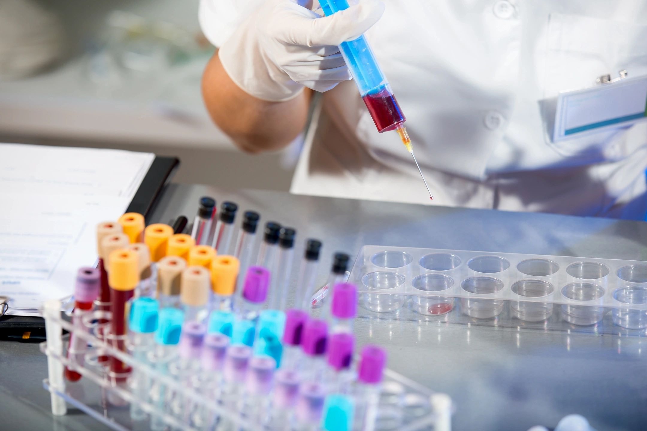 TBI biomarker research
